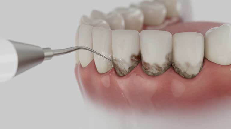 Trusted Teeth Cleaning And Checkup service in Stevenson, AL - Dentist Open Now